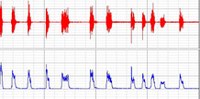 "Combining Electromyography and Tactile Myography to Improve Hand and Wrist Activity Detection in Prostheses" paper posted on Technologies/ journal social media platform